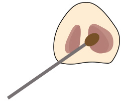 鼻から侵入するウィルスをブロック